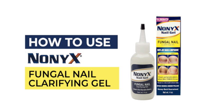 thumbnail video image 3 of Nonyx Nail Gel Restores Fungus Damaged Nails, a Clinically Proven Toenail Treatment, 90% of Nails Improve, Money-Back Guaranteed, 4 oz, 3 of 12